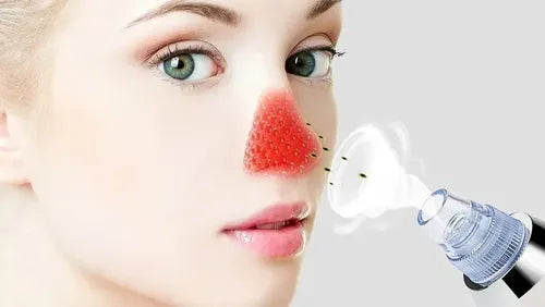 Máquina Succionadora De Puntos Negros Y Acné Derma Suction