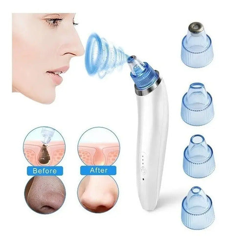 Máquina Succionadora De Puntos Negros Y Acné Derma Suction