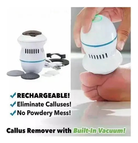 Removedor De Callos Usb Recargable Chamos Con Aspirador Y Cabezales