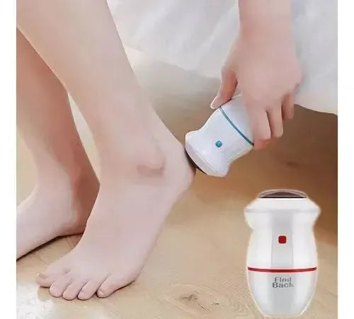 Removedor De Callos Usb Recargable Chamos Con Aspirador Y Cabezales
