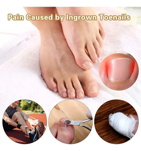 Pack X3 Cajas Parches Anti Hongos Uñas Fúngicos Fungal Nail Color Crema